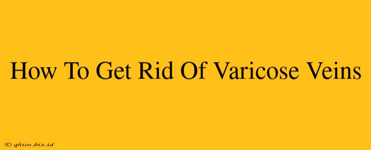 How To Get Rid Of Varicose Veins