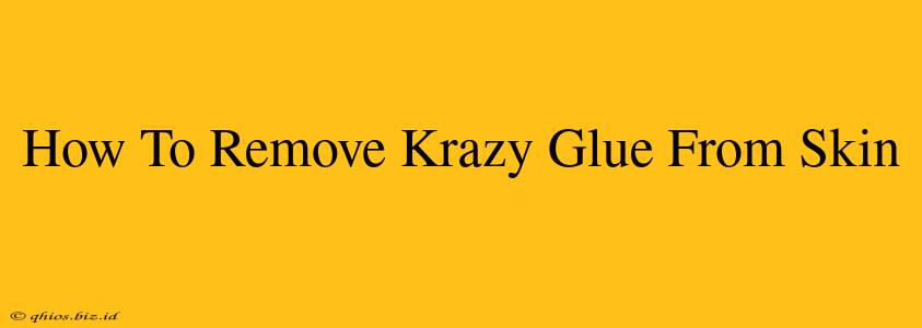 How To Remove Krazy Glue From Skin