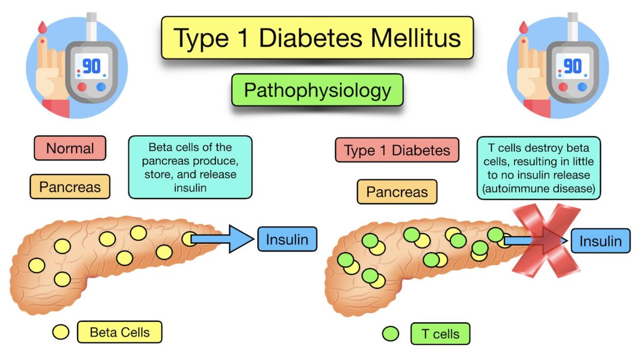 Diabetes-Komplikationen: Risiken verstehen und aktiv vorbeugen – Ein umfassender Ratgeber