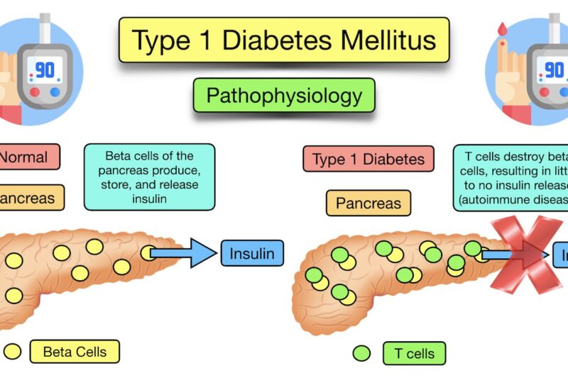 Diabetes-Komplikationen: Risiken verstehen und aktiv vorbeugen – Ein umfassender Ratgeber